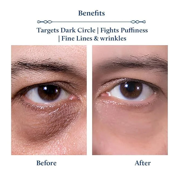Blue Nectar Shubhr Under Eye Cream for Dark Circles with Papaya, Potato Starch & Niacinamide | Best Under Eye Cream for Me...