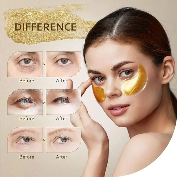 Under Eye Patches (30 Pairs), 24K Gold Under Eye Mask for Puffy Eyes, Dark Circles,Bags and Wrinkles with Collagen,Relieve...