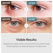 TX Tranexamic Acid Retinalsome Dual Eye Cream with Adenosine Niacinamide for Dark circle Repairing | Daily Anti-Aging Unde...