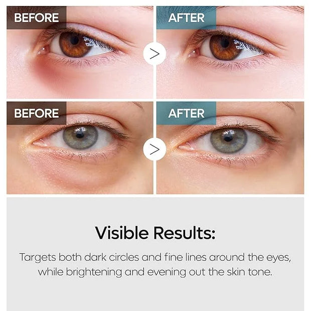 TX Tranexamic Acid Retinalsome Dual Eye Cream with Adenosine Niacinamide for Dark circle Repairing | Daily Anti-Aging Unde...