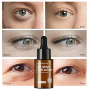 Retinol Eye Serum, Anti-Aging with Hyaluronic Acid Vitamin E Ceramide for Dark Circle, Fine Lines & Under Eye Bags Visibly...