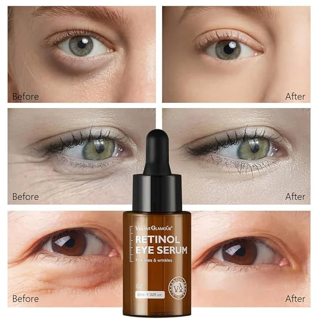 Retinol Eye Serum, Anti-Aging with Hyaluronic Acid Vitamin E Ceramide for Dark Circle, Fine Lines & Under Eye Bags Visibly...