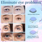 Under Eye Patches (18 Pairs) - Pearl Eye Mask with Natural Marine Collagen, Hyaluronic HA - Reduce Wrinkles, Puffy Eyes, D...