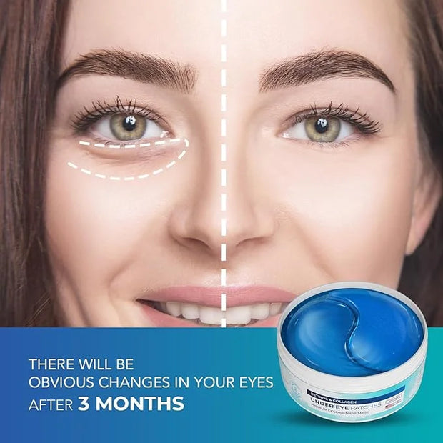 Under Eye Patches for Dark Circles: Under Eye Mask for Wrinkles - Eye Bags - Fine Lines - Puffy Eyes - Gel Mask - Amino Ac...