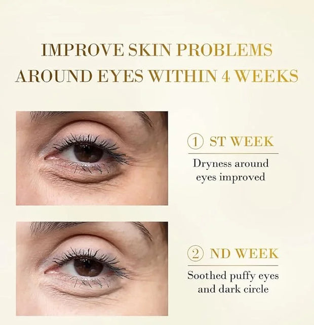 Senana MarinaUnder Eye Masks, Eye Lines And Moisturizing Eye Patches, Moisturizing, Nourishing, Improving Eye Bags, Dark E...