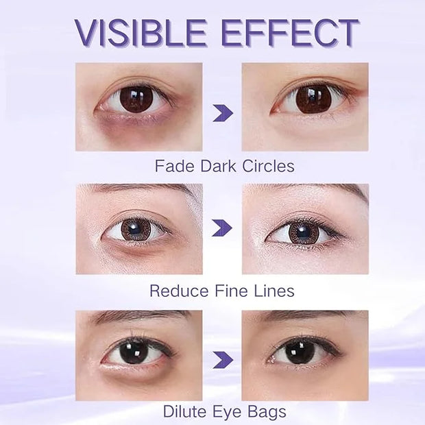Eye Cream for Dark Circles and Puffiness - Retinol Eye Cream Anti Aging -Ey e Bags Treatment for Women - Caviar Eye Se rum...