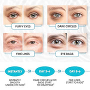 Under Eye Patches for Puffy Eyes, Dark Circles, Dull Skin - Natural Moisturizing Support - Help with Wrinkles and Fine Lin...
