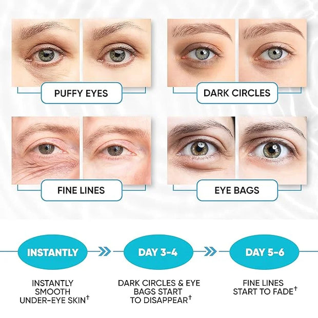 Under Eye Patches for Puffy Eyes, Dark Circles, Dull Skin - Natural Moisturizing Support - Help with Wrinkles and Fine Lin...
