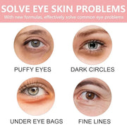30 Pairs Lip Mask & Eye Mask,Under Eye Patches For Reducing Fine Lines & Dark Circles,Moisturizing Lip Spa Daily Labial Ma...