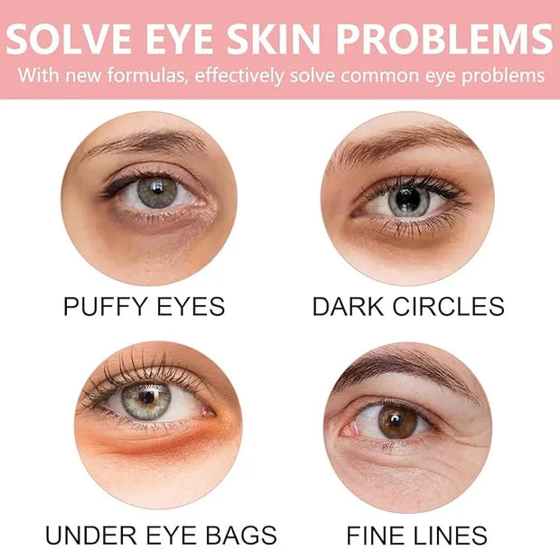 30 Pairs Lip Mask & Eye Mask,Under Eye Patches For Reducing Fine Lines & Dark Circles,Moisturizing Lip Spa Daily Labial Ma...
