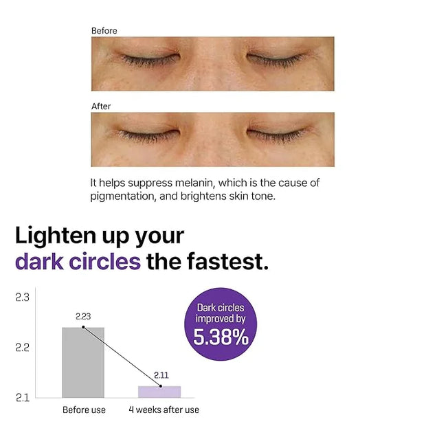SOME BY MI Retinol Intense Advanced Triple Action Eye Cream – 1.01Oz, 30ml – Korean Retinol Under Eye Cream Anti Aging for...