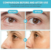 Anti-Aging Eye Cream for Wrinkles Under Eye Cream with Snail Mucin for Fine Lines Puffiness - Firming Eye Serum Relieve Ey...