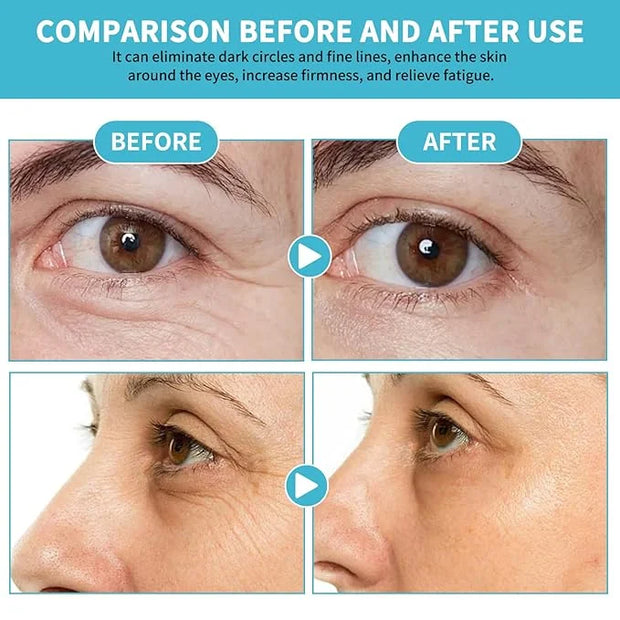 Anti-Aging Eye Cream for Wrinkles Under Eye Cream with Snail Mucin for Fine Lines Puffiness - Firming Eye Serum Relieve Ey...
