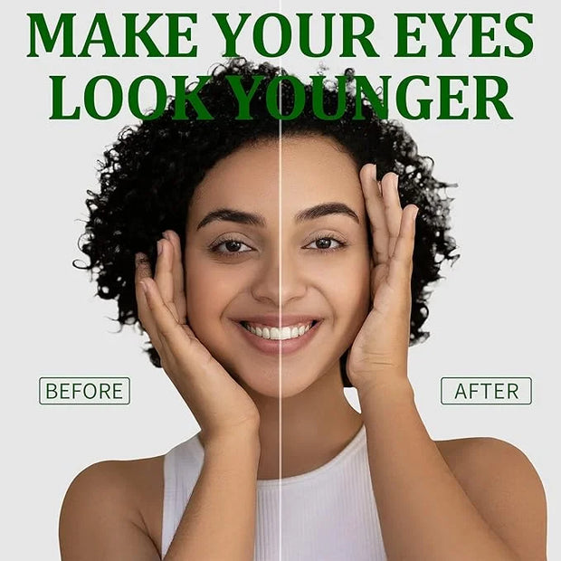 R.A.V Under Eye Patches, Eye Masks, 30 Pairs Collagen Patches for Nourish Firming Repair for Fine Lines, Wrinkles, Dark Ci...