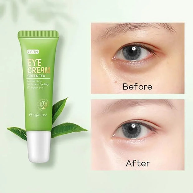 AKARY Green Tea Eye Care Cream Eliminate Eye Bag Dark Circles Tea Leaf Extract Eye Cream for Nourishing Eye Areas & Tighte...