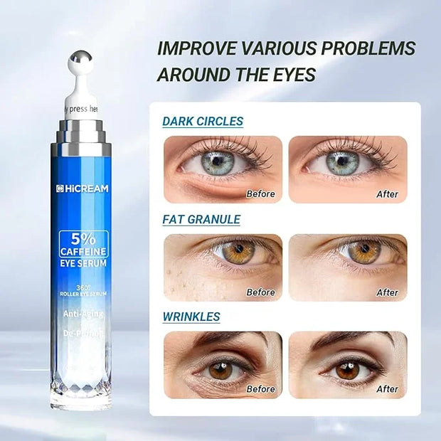Eye Cream with 5% Caffeine Hyaluronic Acid for Puffy, Fine Lines, Dark Circles and Wrinkles, Under Eye Serum with 360° Rol...