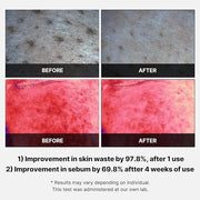 Medicube Red Succinic Acid Panthenol Facial Peeling Pads - Exfoliating Toner Pads for Breakout-Prone Skin with Niacinamide...