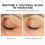 MOMOHOO Retinol Caffeine Under Eye Cream – Anti-Aging Eye Cream with Soluble Collagen for Puffiness, Wrinkles, and Under-E...