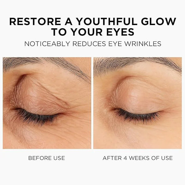 MOMOHOO Retinol Caffeine Under Eye Cream – Anti-Aging Eye Cream with Soluble Collagen for Puffiness, Wrinkles, and Under-E...
