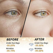 Golden Glow Under Eye Patches for Puffy Eyes - 60Pcs Eye Gels Rejuvenating Treatment for Dark Circles, Puffiness, Refreshi...