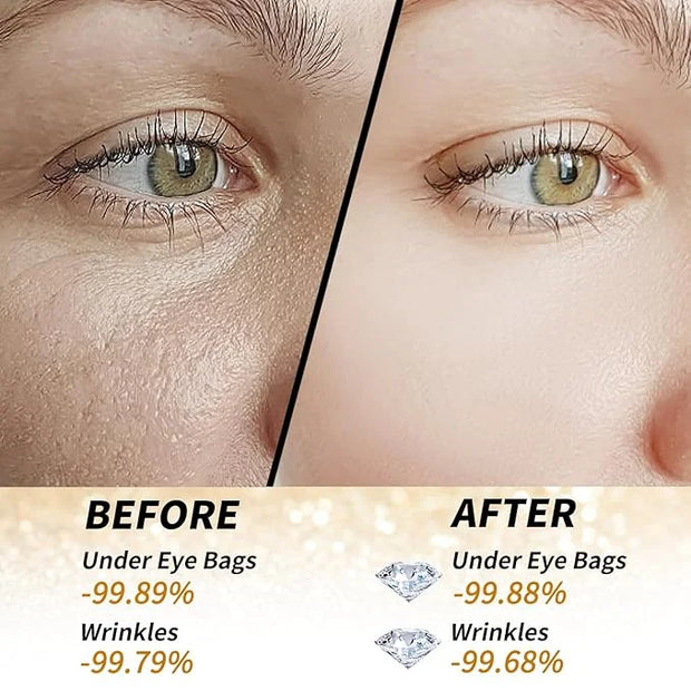 Golden Glow Under Eye Patches for Puffy Eyes - 60Pcs Eye Gels Rejuvenating Treatment for Dark Circles, Puffiness, Refreshi...
