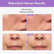 Bakuchiol Serum, 5,000ppm Bakuchiol, Anti-Aging, Pore Minimizer for Face, Hydrating Glow Serum, Facial Moisturizer, Active...
