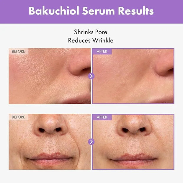 Bakuchiol Serum, 5,000ppm Bakuchiol, Anti-Aging, Pore Minimizer for Face, Hydrating Glow Serum, Facial Moisturizer, Active...