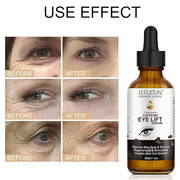 Caffeine Eye Serum + EGCG, Eye Serum for Dark Circles and Puffiness, Under Eye Serum Reduces Puffiness, Dark Circles, Unde...