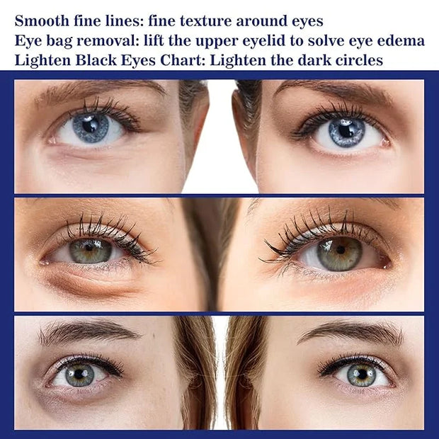 Under Eye Cream for Puffiness & Bags,Active Eye Serum for Dark Circles and puffiness,Under Eye Caffeine Eye Serum Reduce W...