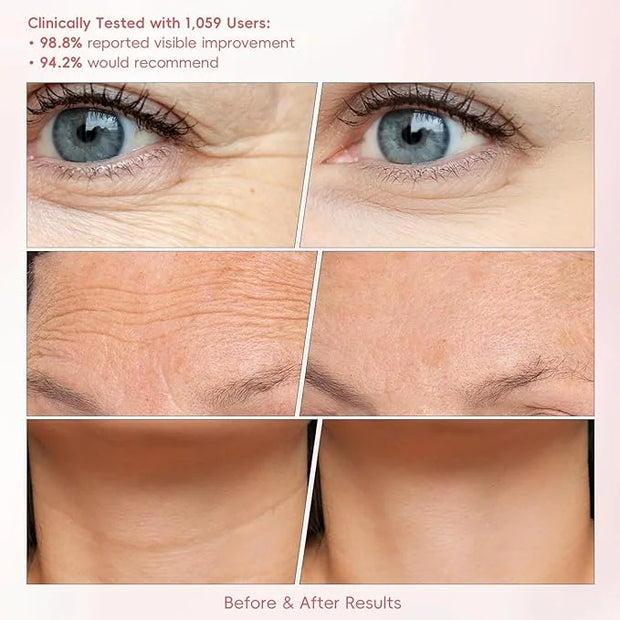 Peunitory Eye Balm, Under Eye Cream Brightener Balm Stick For Wrinkles Dark Circle Treatment Moisturizing Relief Skin Elas...