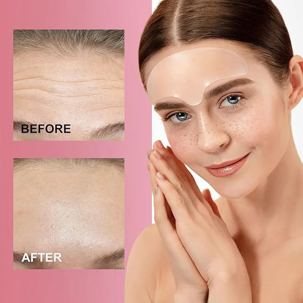Reusable Wrinkle Patches - Silicone Fusion Treatment Forehead Patches for Brow Lift, Wrinkle Smoothers, Reduce Frown Lines...