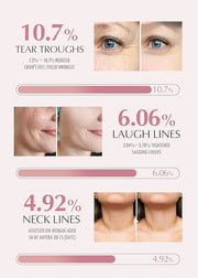 KAHI Wrinkle Bounce Multi Balm Stick | PDRN Collagen Wrinkle Stick | Korean Skin Care |All-in-One Hydrating Lip Balm Eye C...