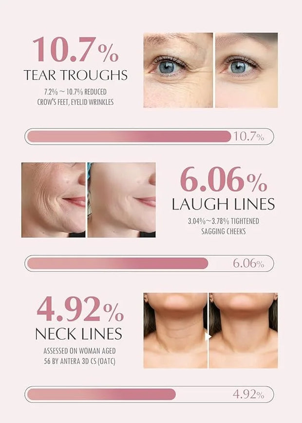 KAHI Wrinkle Bounce Multi Balm Stick | PDRN Collagen Wrinkle Stick | Korean Skin Care |All-in-One Hydrating Lip Balm Eye C...