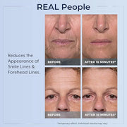 Plexaderm Rapid Reduction Eye Serum - Visibly Reduces Under-Eye Bags, Wrinkles, Dark Circles, Fine Lines & Crow's Feet Ins...