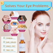Caffeine Solution 5% + EGCG, Caffeine Eye Serum For Face, Moisturizing Under Eye Solution For Reduces Dark Circles & Puffi...