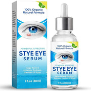 Stye Eye Treatment, Natural Stye Eye Relief Serum, for Styes Chalazion and Blepharitis Treatment, Restored Healthier Eye S...