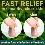 Tea Tree Foot Scrub with Salicylic