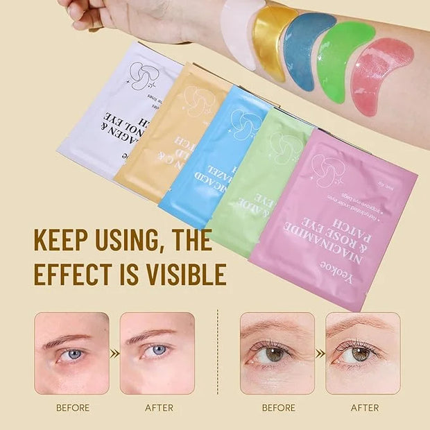 Under Eye Patches for Dark Circles,Eye Mask for Puffy Eyes With Collagen,Retinol,Vitmin C,Hyaluronic Acid and Niacinamide ...