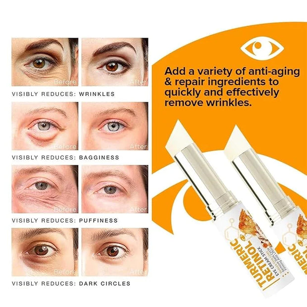 Lumibalm for Under Eye Bags, Turmeric Retinol Eye Cream Stick, Retinol Eye Cream Stick for Dark Circles, Wrinkles, Anti-Ag...