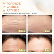 12Pcs Forehead Wrinkle Patches for Women, Hydrolyzed | Collagen | Vitamin E | Aloe Vera to Reduce Wrinkles Forehead Wrinkl...