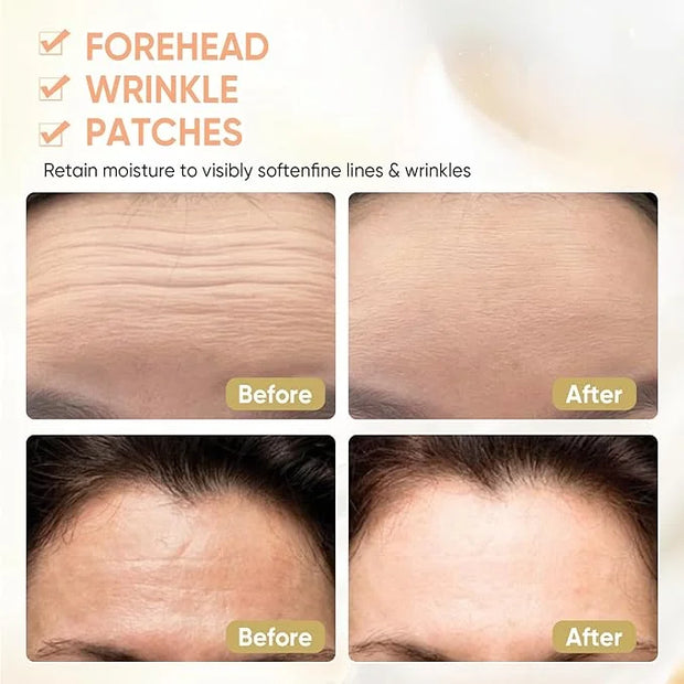 12Pcs Forehead Wrinkle Patches for Women, Hydrolyzed | Collagen | Vitamin E | Aloe Vera to Reduce Wrinkles Forehead Wrinkl...