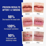 Lip Balm Treatment with Beeswax, Peppermint Chapping