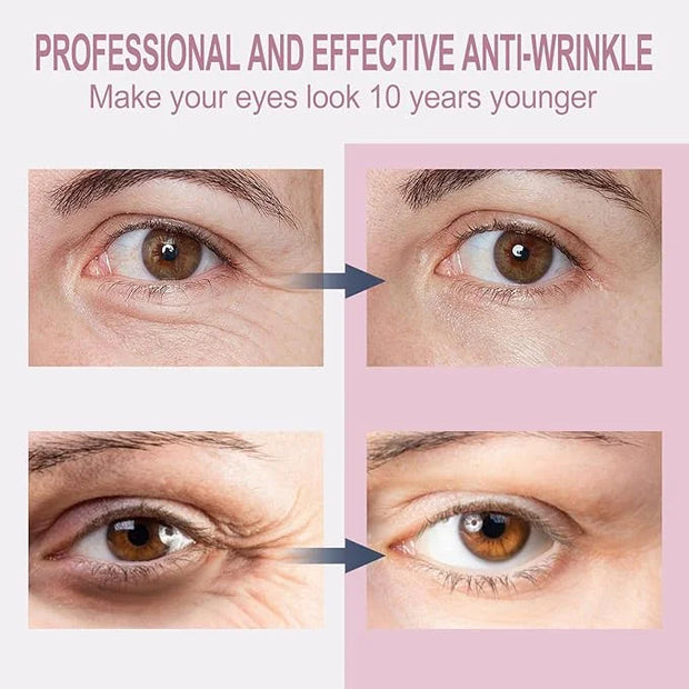 Temporary Eye Tightener Eye Cream - Retinol & Hyaluronic Acid Infused Formula, Quickly Repairs Wrinkles While Reducing Und...