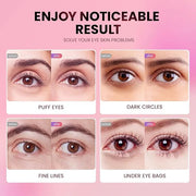 Under Eye Patches (36 Pairs) - New Tri-color Glitter Eye Gel Pads for Dark Circles Puffy Eyes,Under eye Bags,Wrinkles|Natu...