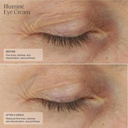 Senté Illuminé Eye Cream | Diminish Dark Circles, Discoloration, Redness, and Puffiness Around The Eyes | with Patented HS...