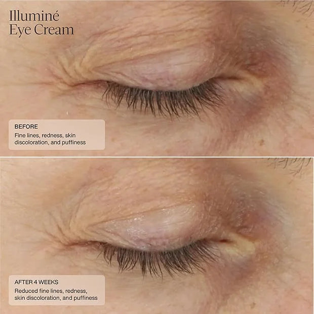 Senté Illuminé Eye Cream | Diminish Dark Circles, Discoloration, Redness, and Puffiness Around The Eyes | with Patented HS...