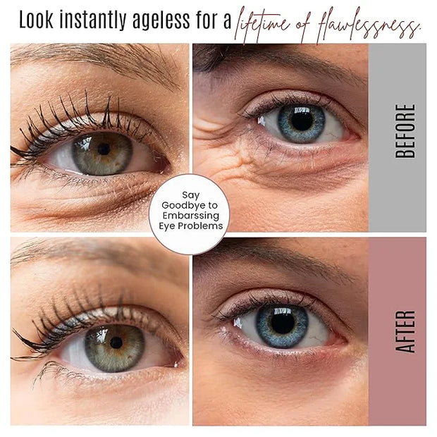 Instant Eyelift Cream Time Reverse Treatment For Dark Circles, Puffy Eyes, & Wrinkles Anti Aging Serum Reduces Under Eye B...