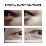 Under Eye Mask Wrinkle Patches, Under Eye Mask Amino Acid & Collagen,Eye Masks for Dark Circles and Puffiness,Eye Wrinkle ...