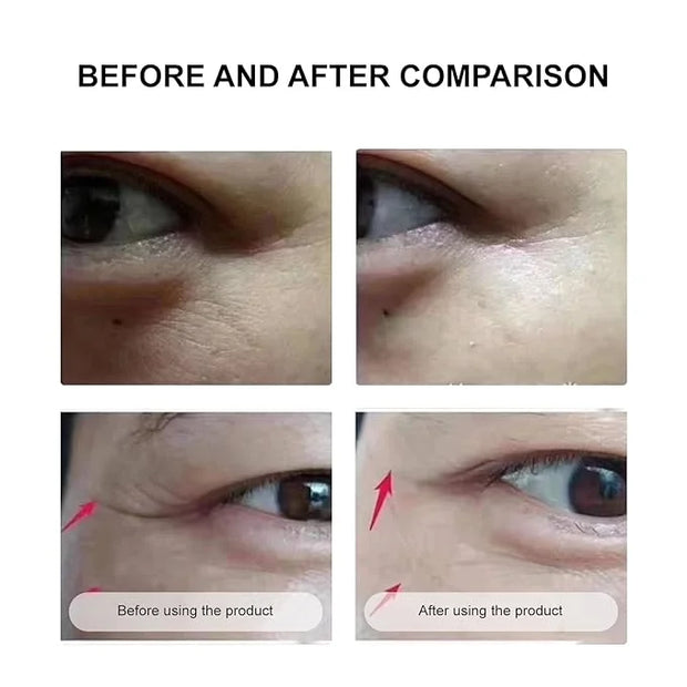 Under Eye Mask Wrinkle Patches, Under Eye Mask Amino Acid & Collagen,Eye Masks for Dark Circles and Puffiness,Eye Wrinkle ...