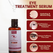 Chalazion Eye Treatment For Blepharitis, 2 PCS Moisturize Eyelids Serum and Chalazion Remover, Gentle Under Eye Relief Ser...